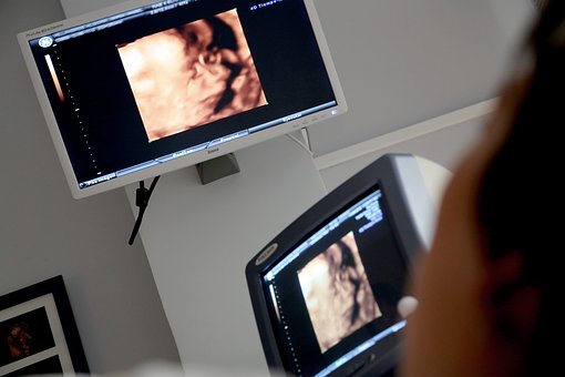 1.26-M Filipino women, girls induced abortion in 2020 – group
