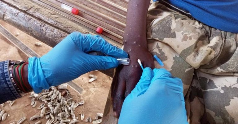 WHO declares mpox a global public health emergency